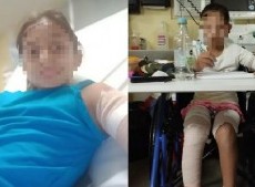Una mujer denunció que un nene de 11 años prendió fuego a su hija por “celos”