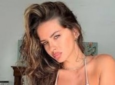 La actriz respondió sin filtro a la consulta de sus fans y habló sobre algunos tratamientos que evalúa a futuro.