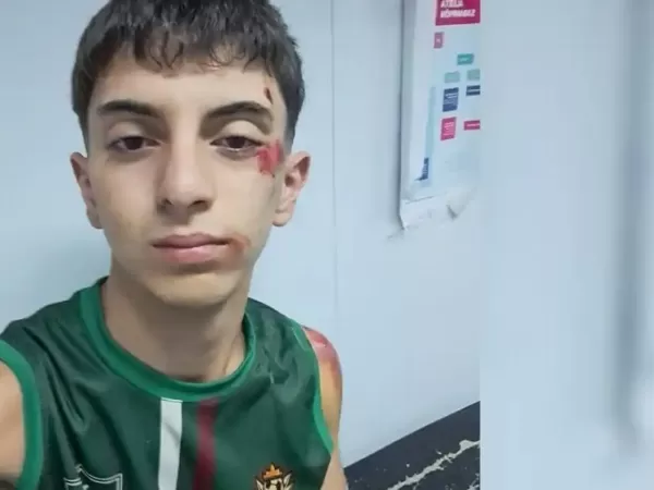 Sali&oacute; al sonar la sirena para ir al cuartel y lo asaltaron