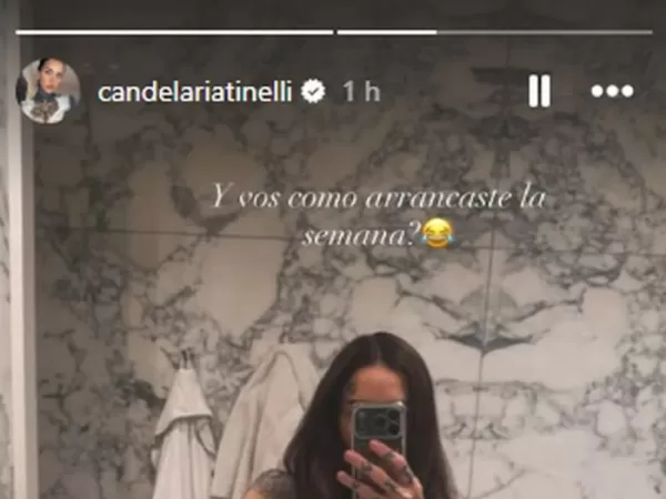 Cande Tinelli sufrió un accidente y será operada