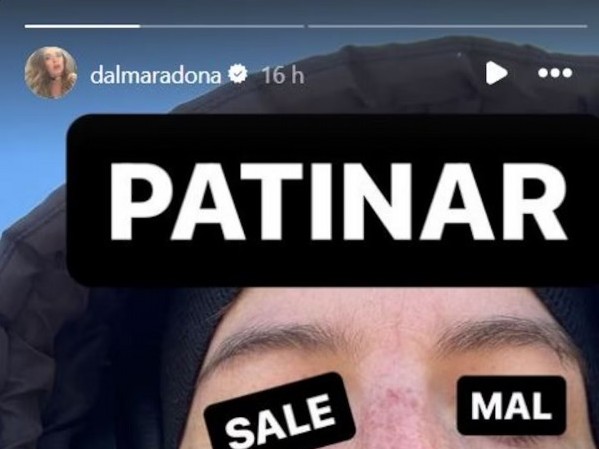 Dalma Maradona salió a patinar, se accidentó y mostró la foto de cómo quedó su cara