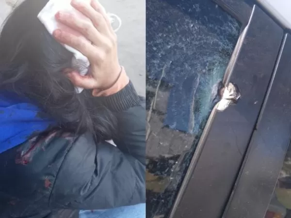 Le rompieron la cabeza y le dispararon a una menor de 16 a&ntilde;os camino a la escuela