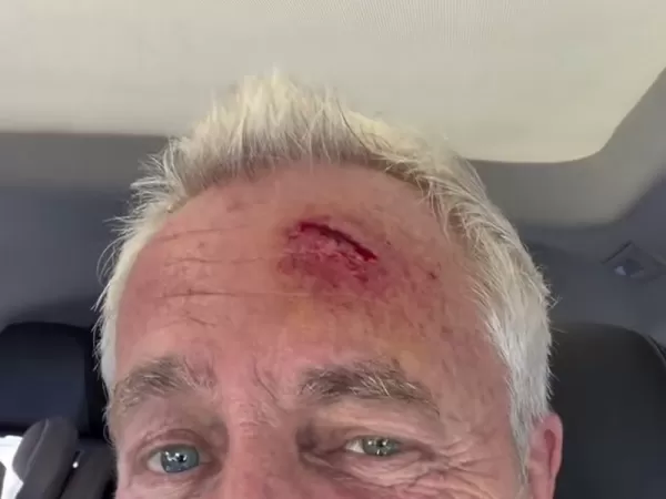 Marley se dio un tremendo golpe en una panader&iacute;a y termin&oacute; en el hospital
