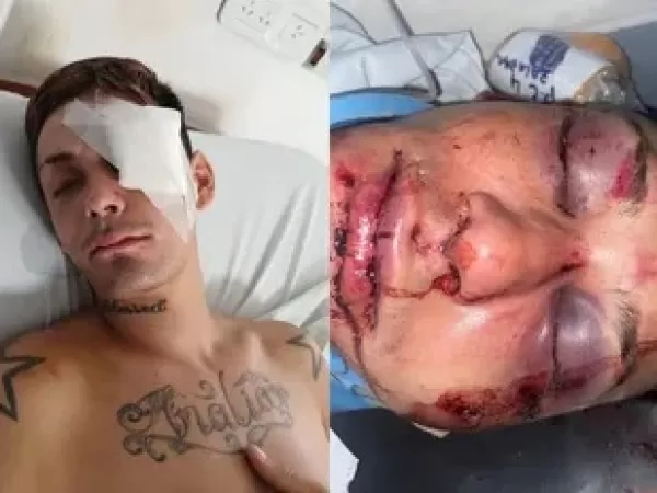 Brutal golpiza a la salida de un boliche