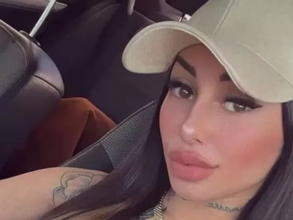 Tamara B&aacute;ez recibi&oacute; cr&iacute;ticas por la cirug&iacute;a que se hizo y su respuesta en redes fue letal