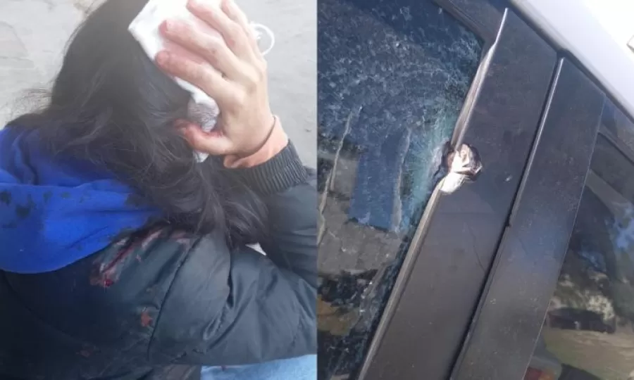 Le rompieron la cabeza y le dispararon a una menor de 16 a&ntilde;os camino a la escuela