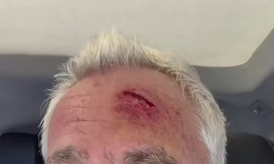 Marley se dio un tremendo golpe en una panader&iacute;a y termin&oacute; en el hospital