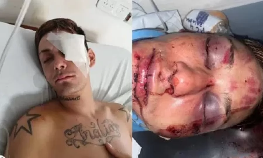 Brutal golpiza a la salida de un boliche
