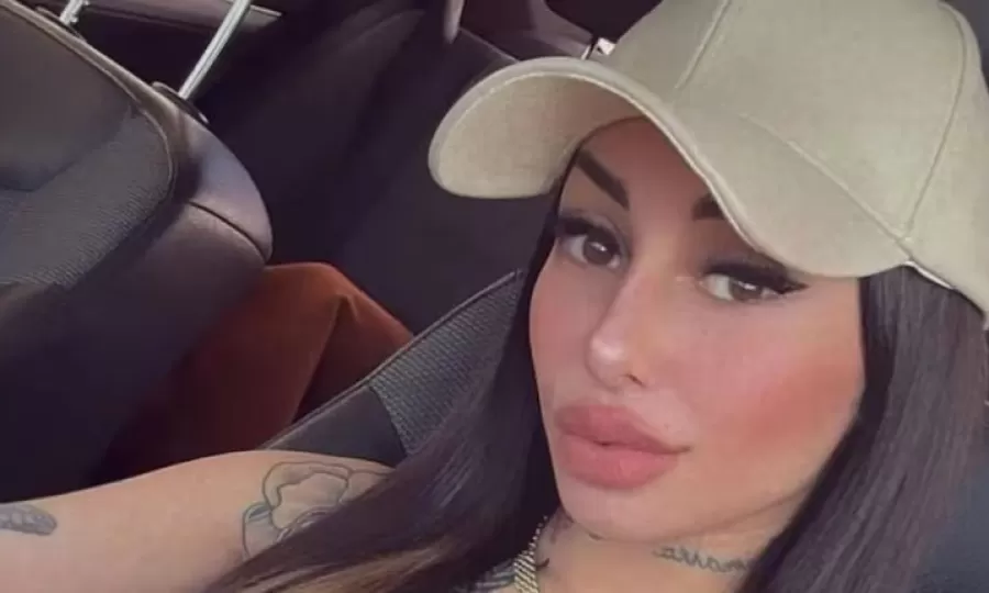 Tamara B&aacute;ez recibi&oacute; cr&iacute;ticas por la cirug&iacute;a que se hizo y su respuesta en redes fue letal